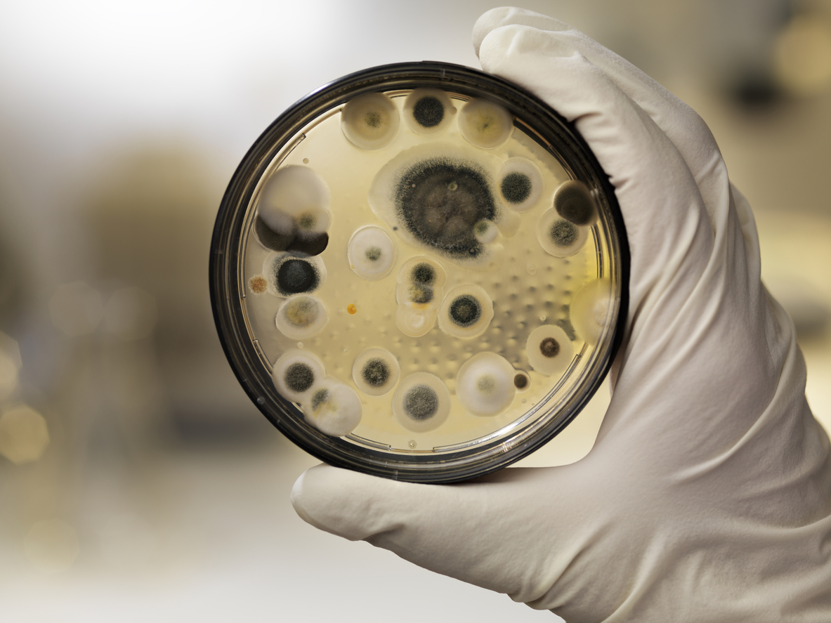 Mildew culture on agar plate, laboratory scene