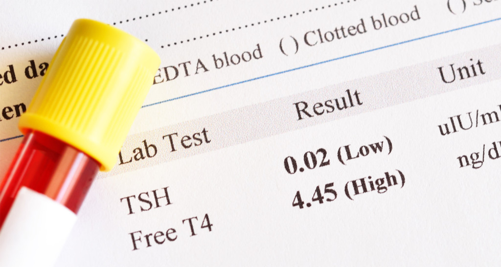 Thyroid panel example